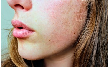 Les meilleurs savons pour la peau sèche 